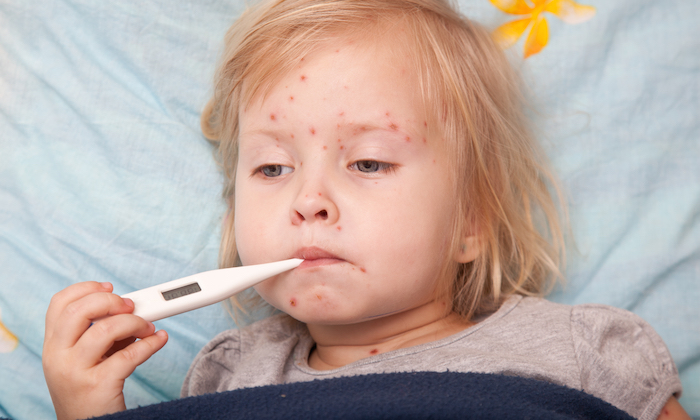 kids-baby-rashes-symptoms-meaning