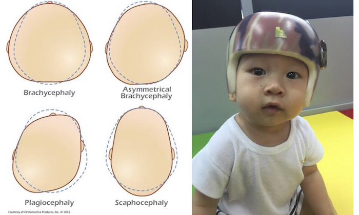 Flat head helmet sales cost