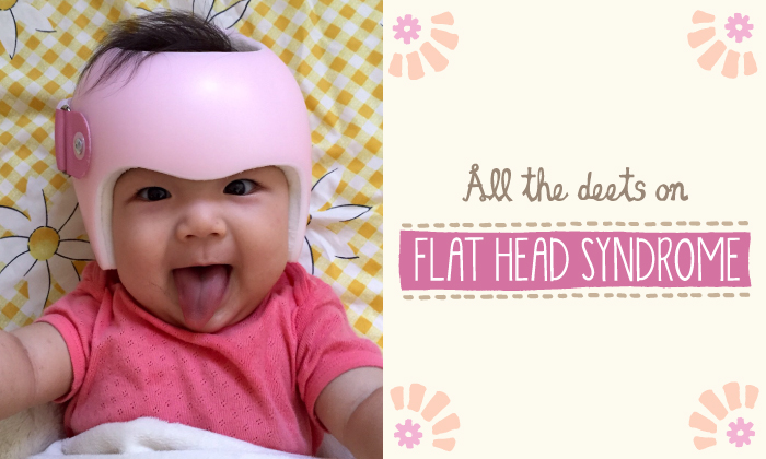 home remedies for flat head baby