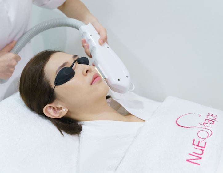 nue shape glycolic peel