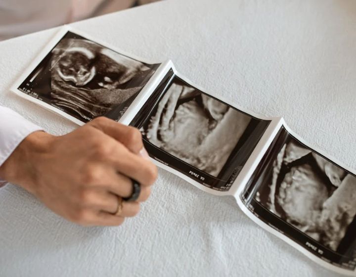 Teen pregnancy - ultrasound scans