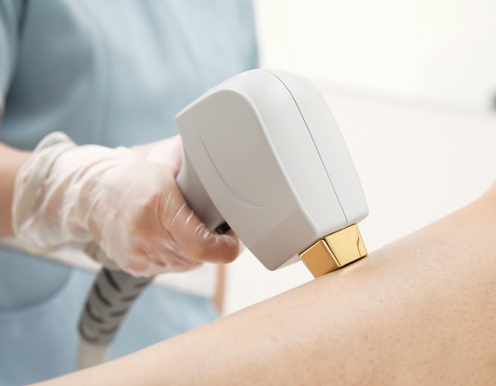 ipl hair removal - brazilian wax - laser hair removal - waxing - waxing singapore - beauty clinic - ipl singapore - hair removal - japan ipl express