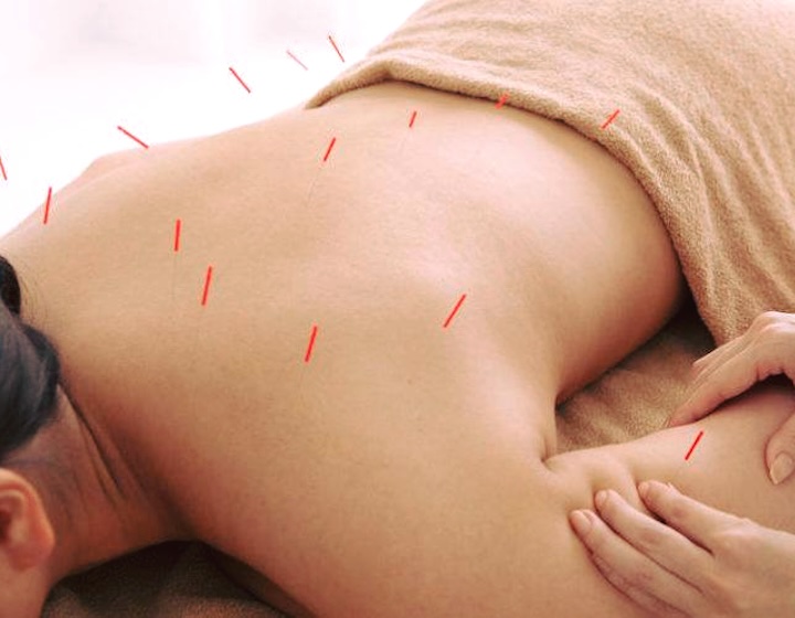 tcm singapore - tcm clinic singapore - acupuncture singapore - chinese medicine - tcm near me - chinese medical centre
